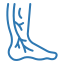 Varicose/Venous Ulcers Treatment